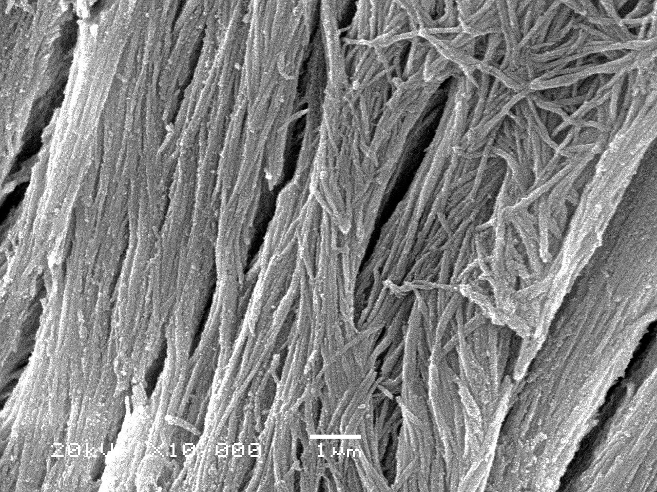 10000 magnification of mineralized collagen fibers in bone